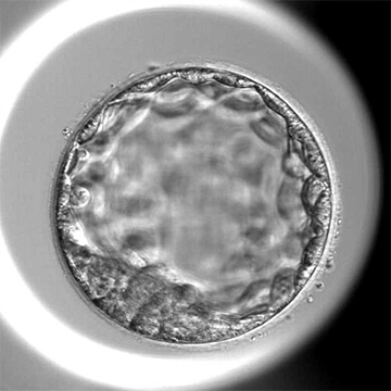 拡張胚盤胞