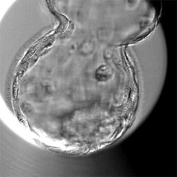 孵化胚盤胞