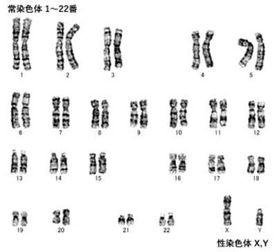 ヒト染色体像の例